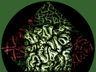 Hirn (Zeichnung: urian)