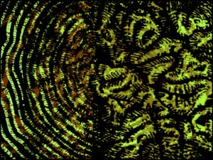 Hirnmasse (Zeichnung: urian)